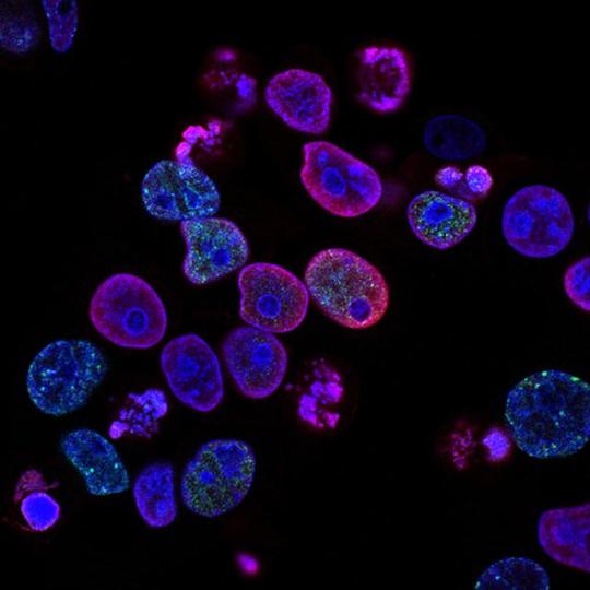 Cell morphology classification